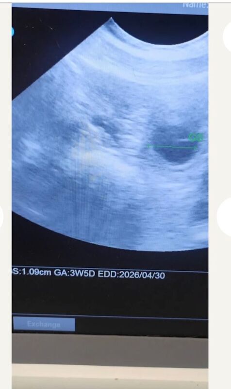 Rottweiler puppies - Image 4 of 5